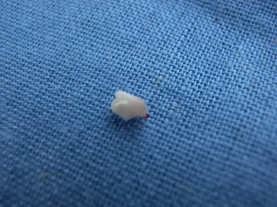 子犬の乳歯